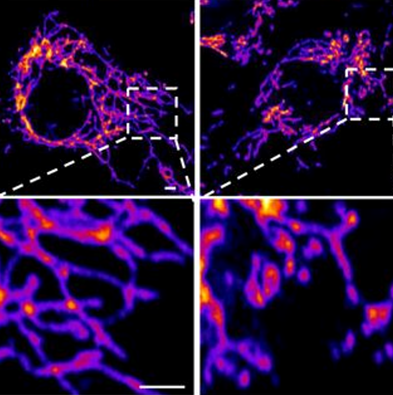 The novel coronavirus’ spike protein plays additional key role in illness - Salk Institute for Biological Studies
